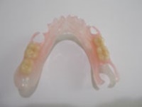 即日完成の総入れ歯・部分入れ歯｜東京入れ歯研究所の入れ歯治療